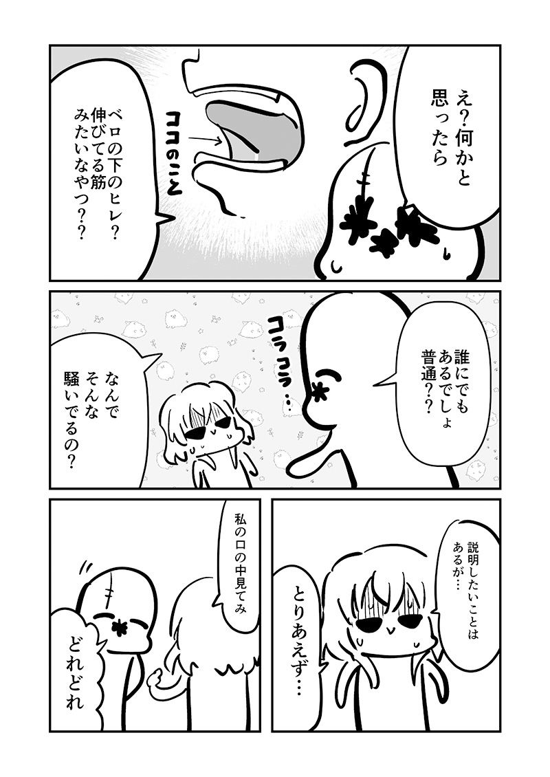 ベロをレーザーで焼いた話1_6